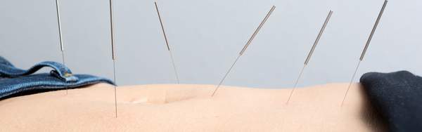 The Benefits of Acupuncture and Tuina for Post-Cancer Patients